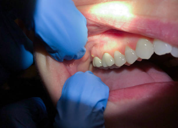 Best Pediatric Emergency Dentist in Northvale, NJ